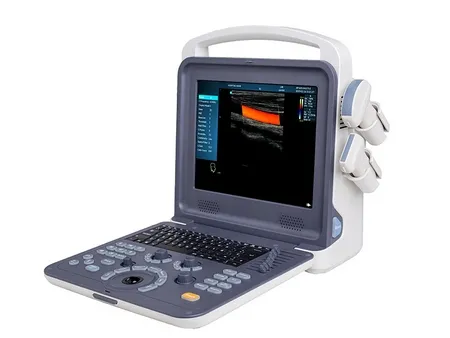 Equipo de Ultrasonido